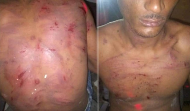 Tortured by 4 soldiers Junior Mouckagni Moussavou was able to see a doctor –