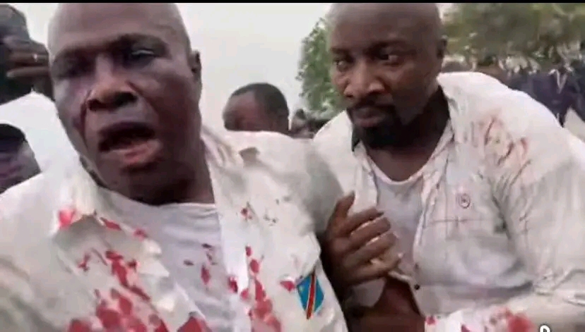 RDC : Martin Fayulu blessé lors d’un rassemblement de l’opposition à Kinshasa -