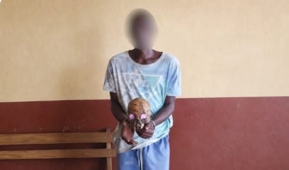 Oyem : un présumé trafic d’ossements humains démantelé, deux suspects interpellés -